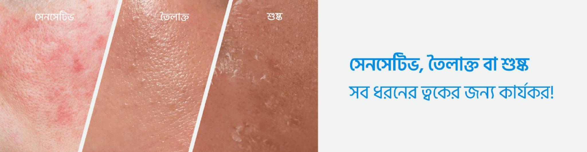 Microdermabrasion Treatment