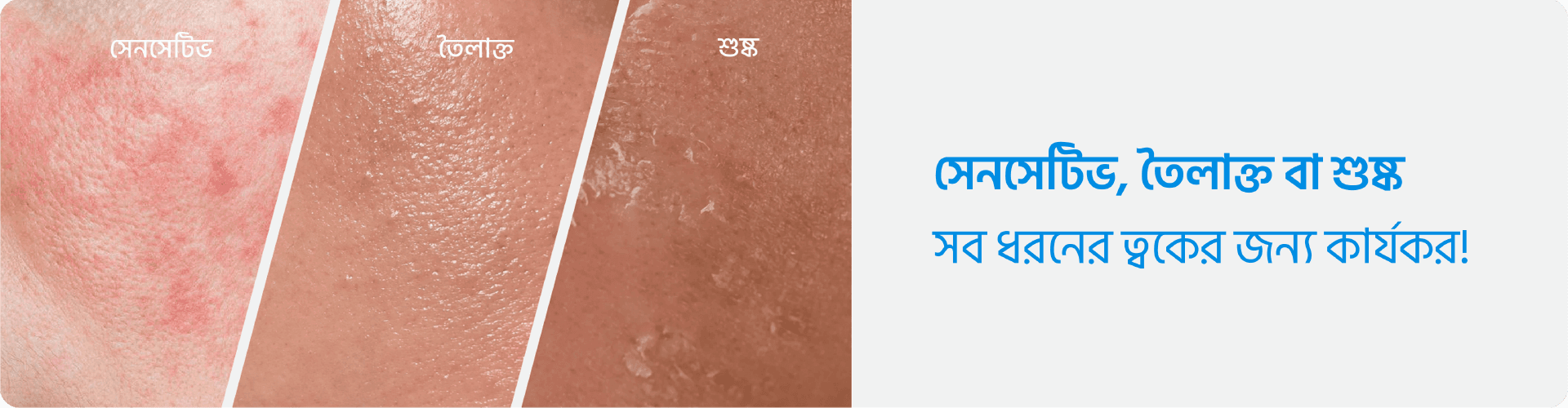 Skin Transformation EPN