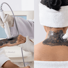 Charcoal Glow Hand & Neck Premium Bio-Hydra Treatment