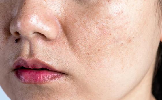 Cellmula Signature AT Solution Intensive Brightening System