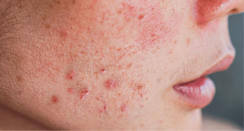 Novaclear Advanced Prebiotic Serum with Niacinamide