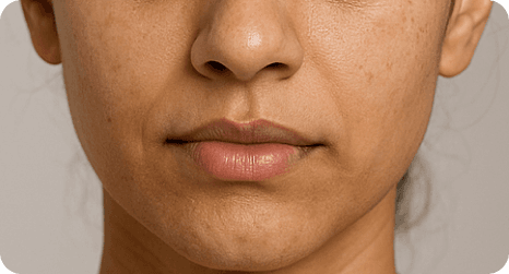 SkinClinic Vita C8 Cream