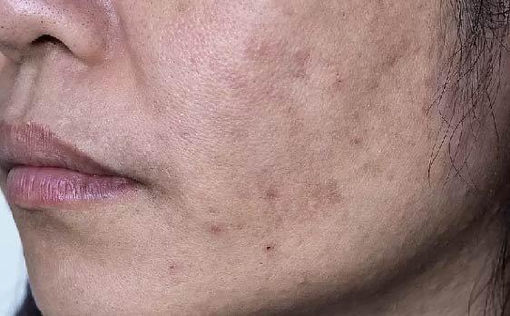 BioCare Bio White Whitening Face Wash