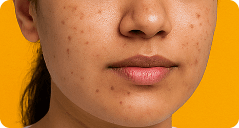 SkinClinic Regulacne