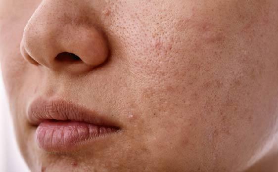 BioCare Vitamin C Whitening Set